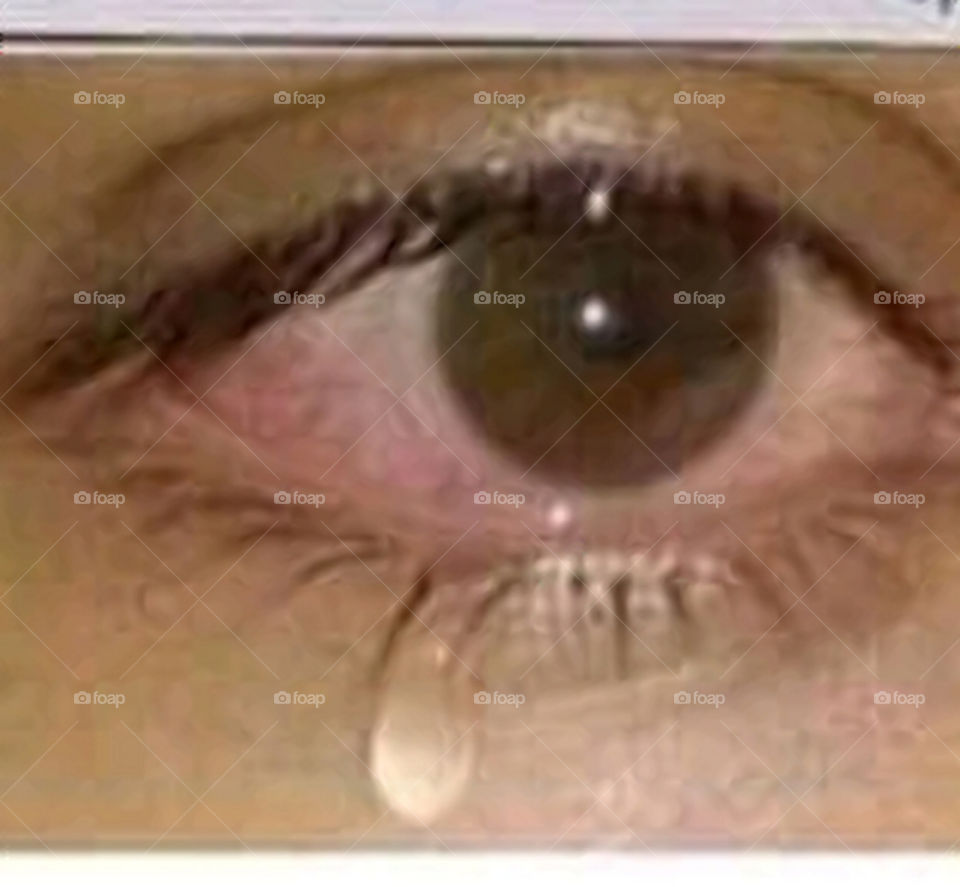 Tear