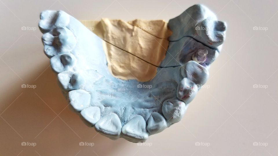 Dental impressions