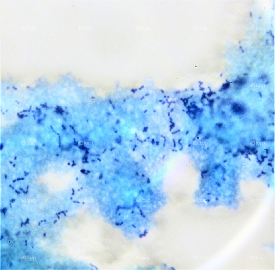 Bacterias del yogur con tinte azul de metileno