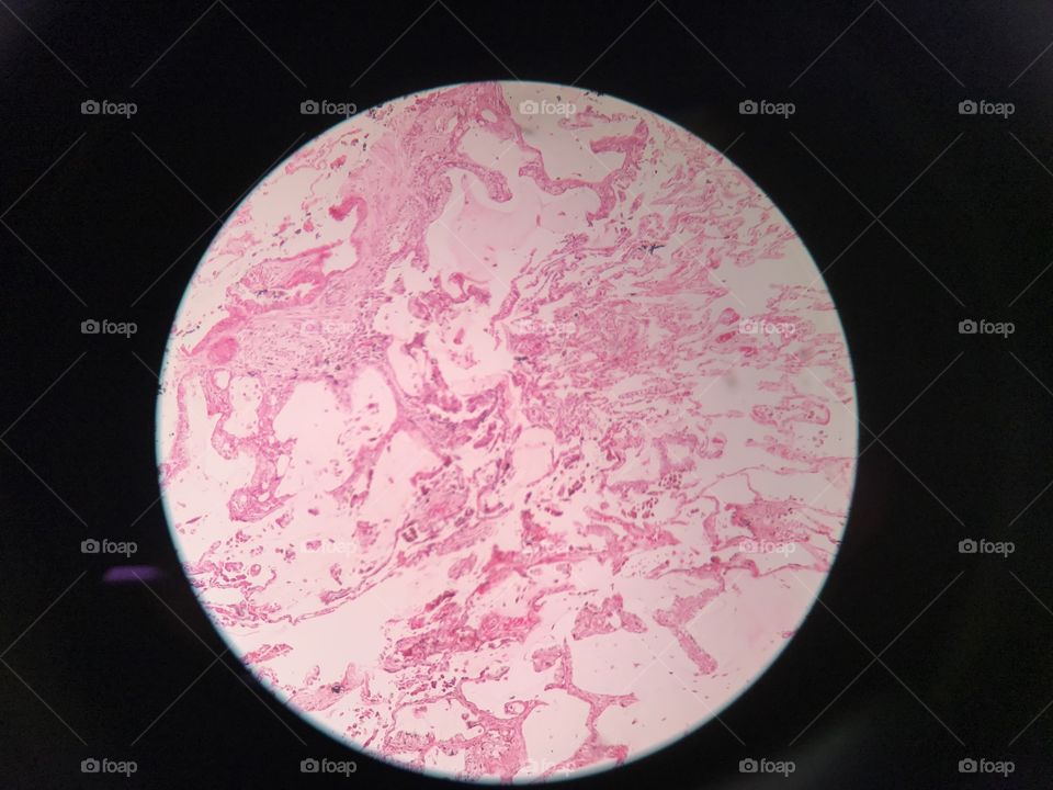 Pictures of histological slides
