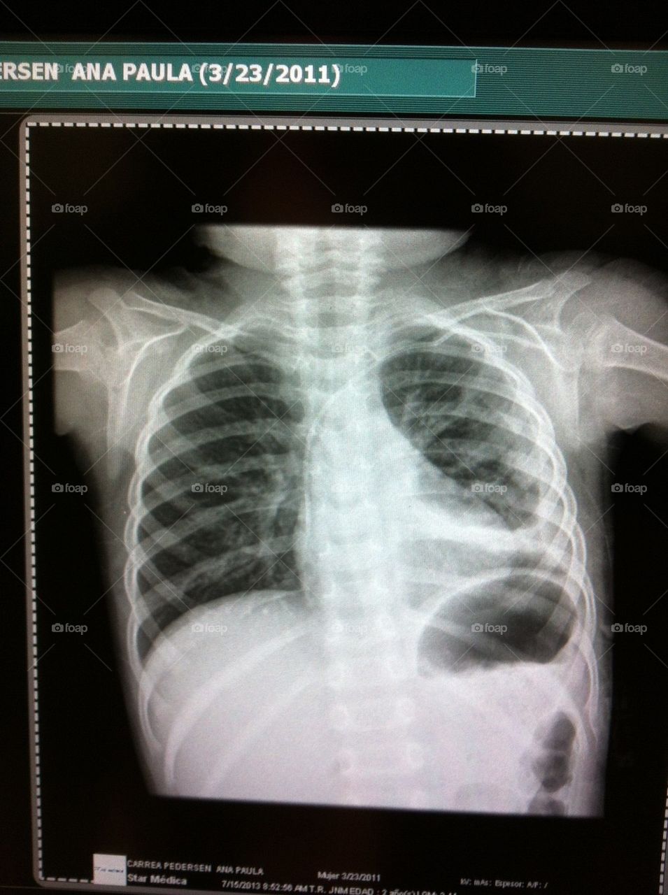 X Ray