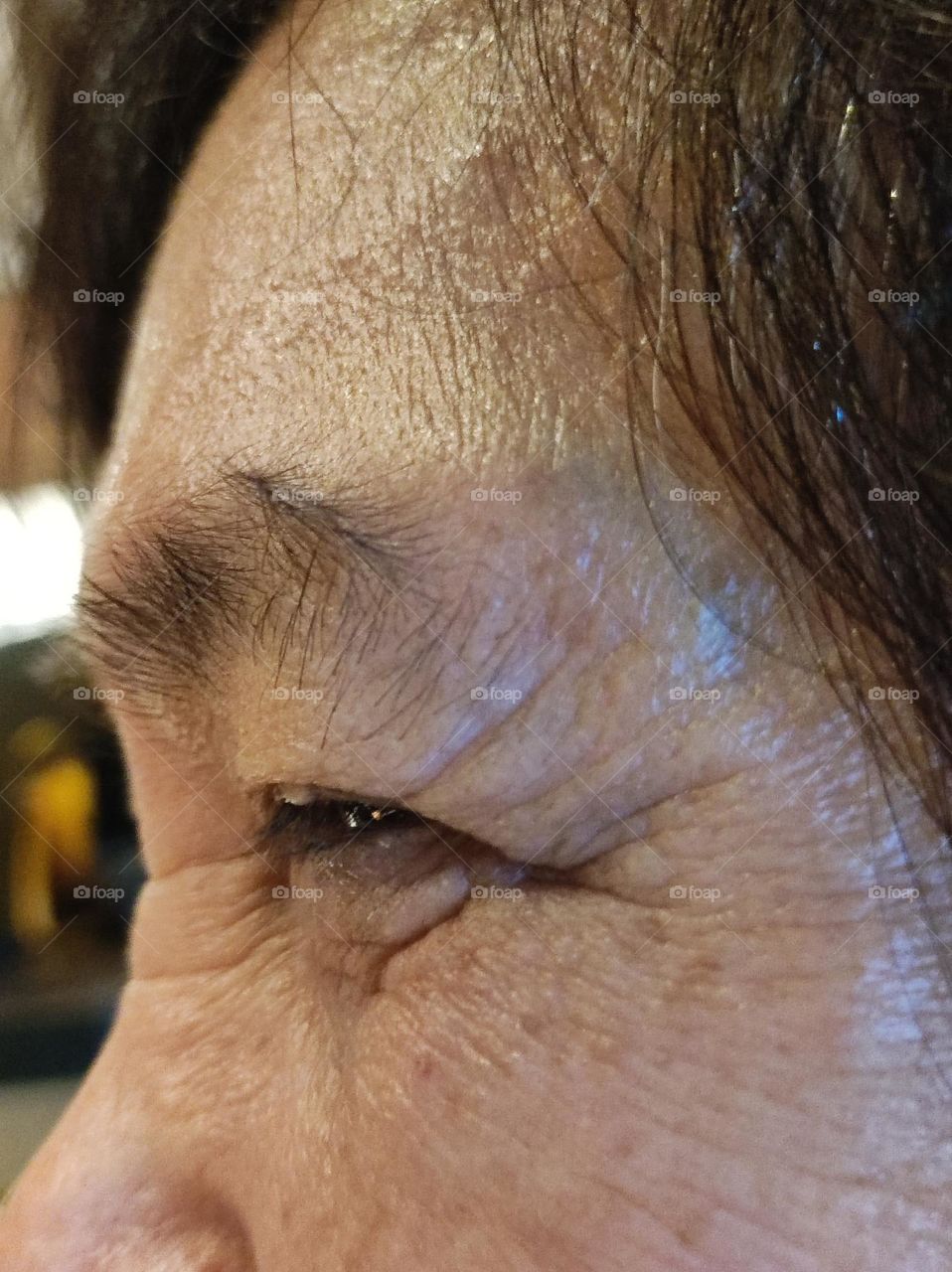 Wrinkles from aging and smiling...