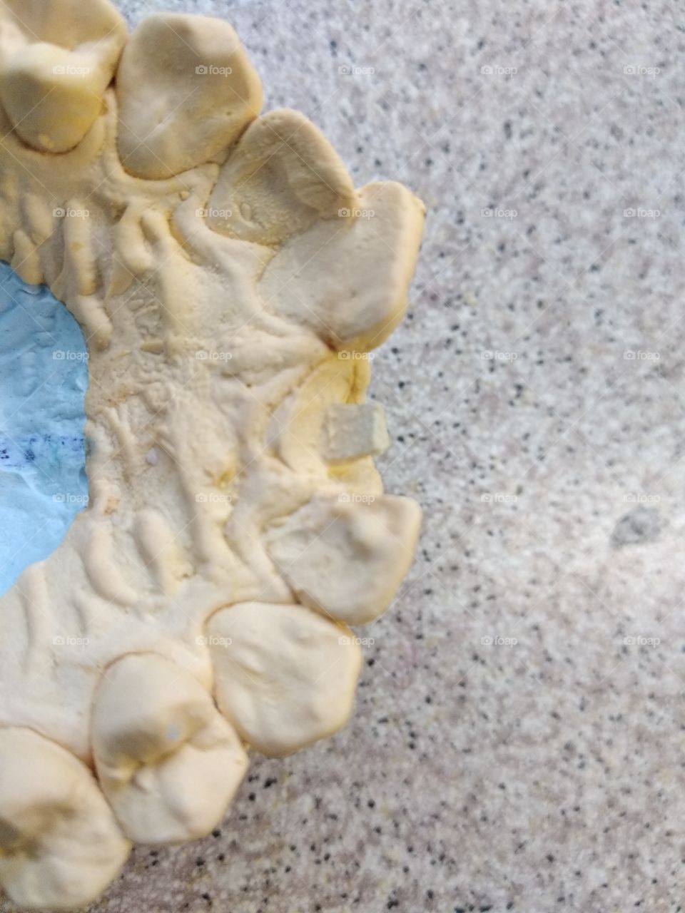 Dental model