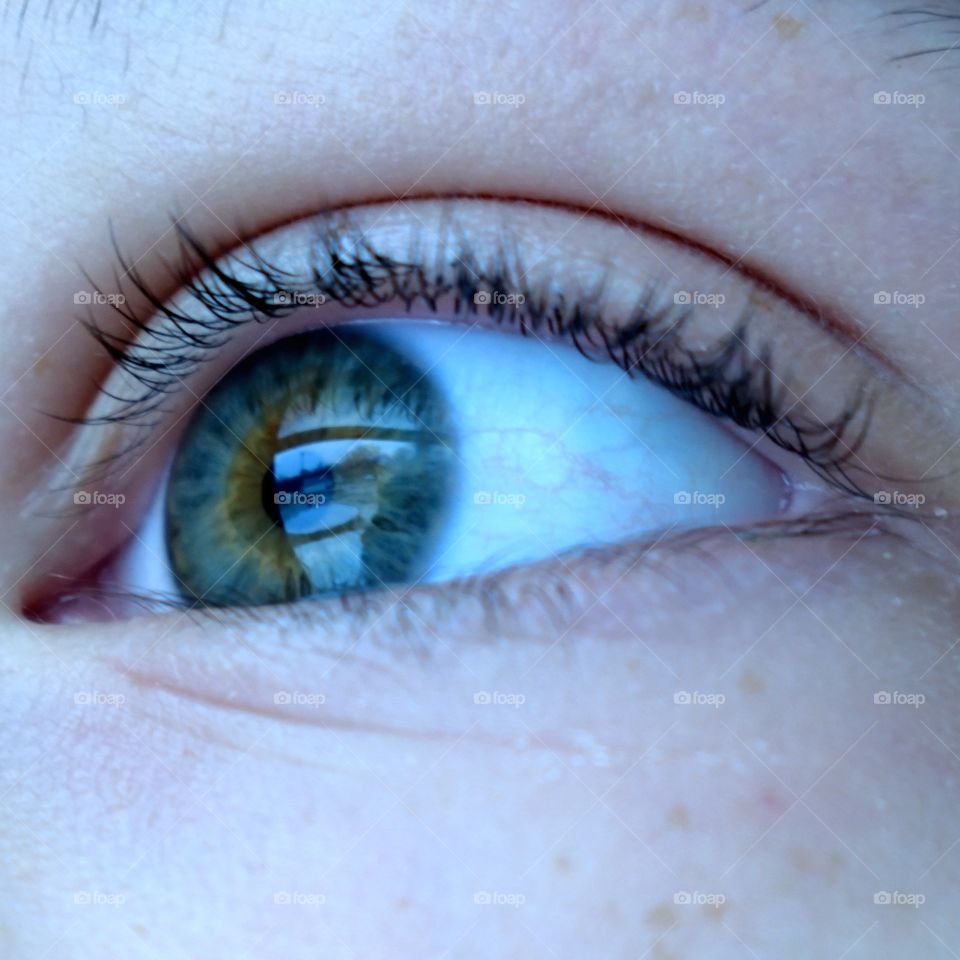 eye