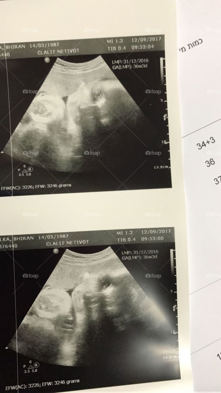 Ultrasound, Radiography, Fetus, Maternity, Scrutiny