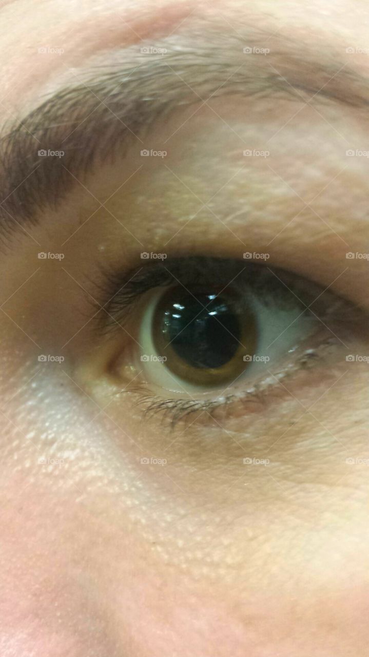 large pupils