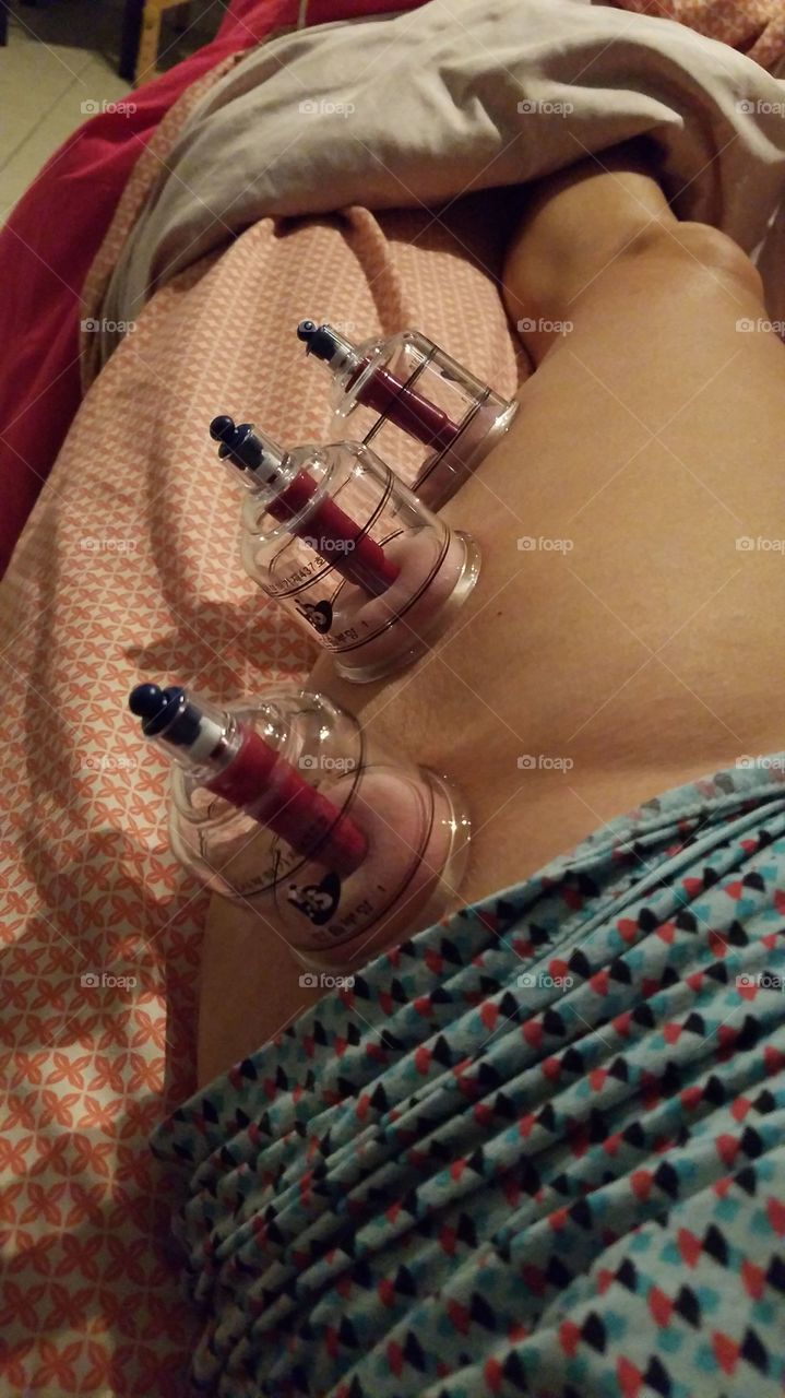 cups therapy,  massotherapist