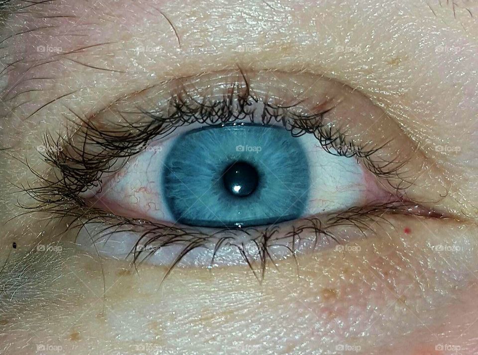 blue eye