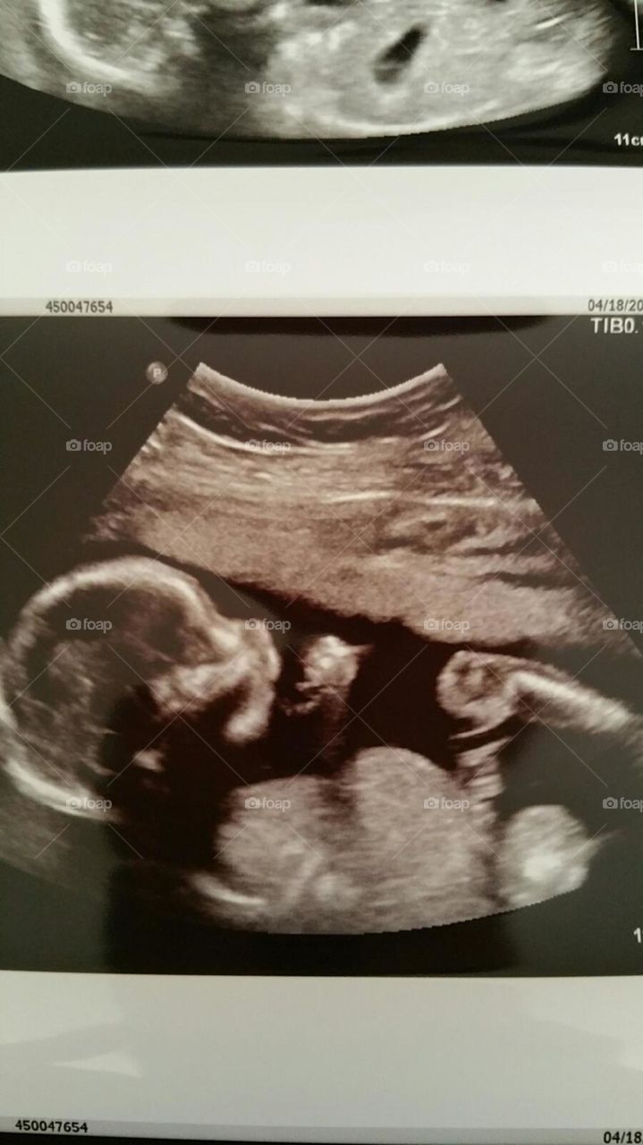 I'm going to be a Great-Aunt !!!