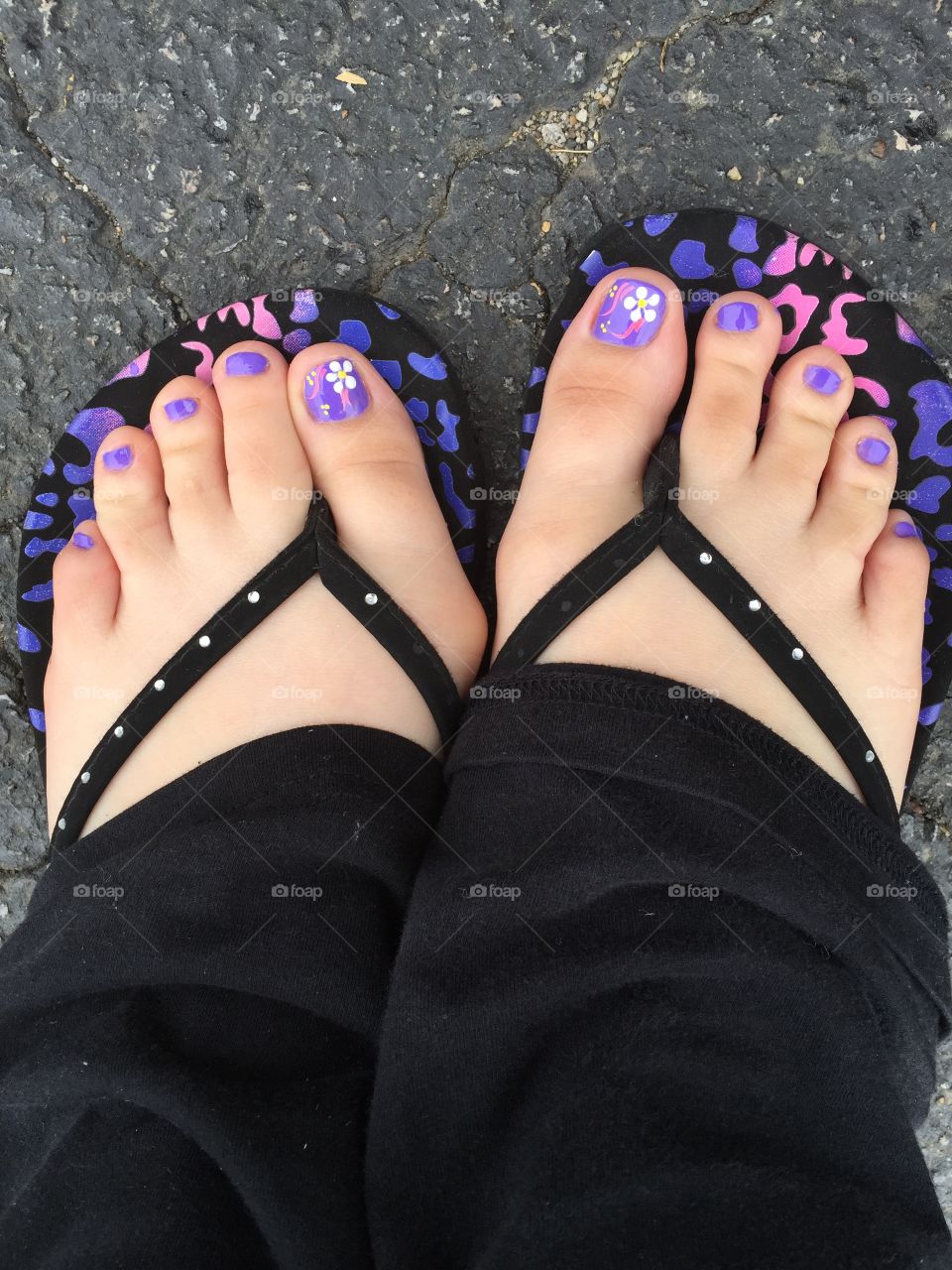 My toes painted a light purple with white flowers on them 