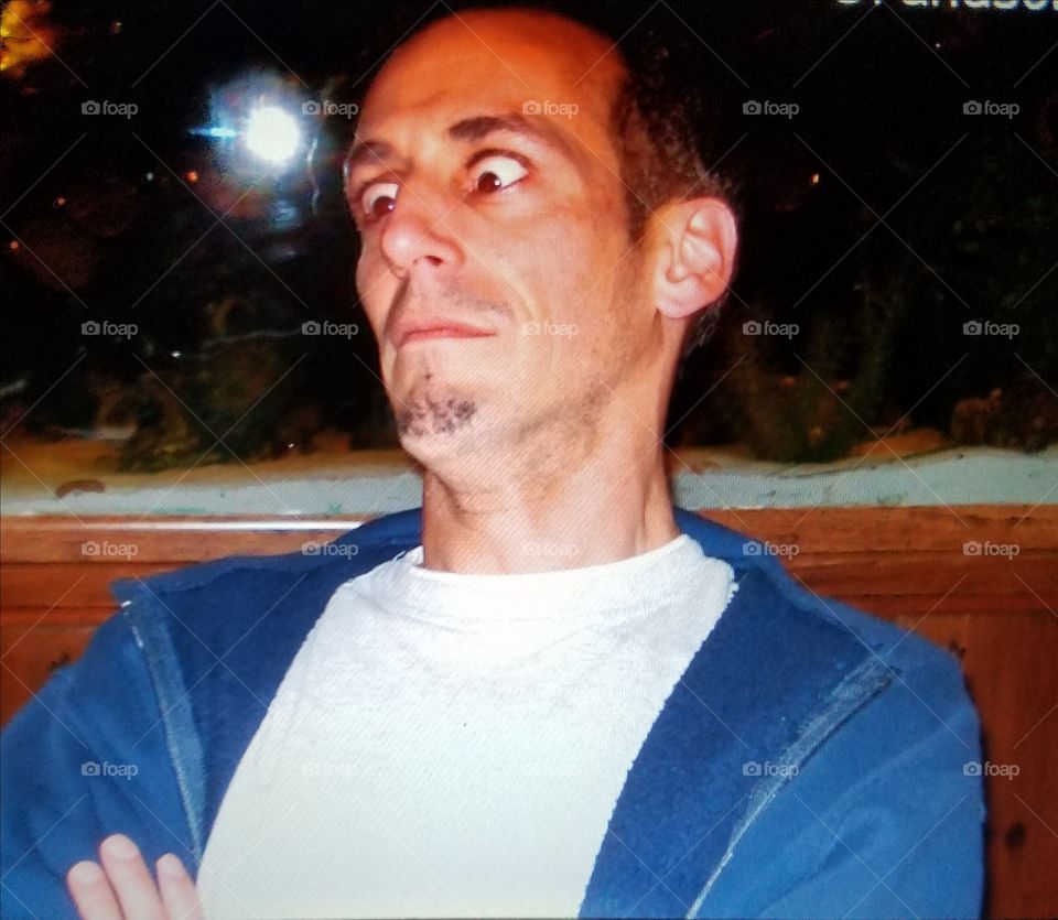 Young man with crossed eyes!