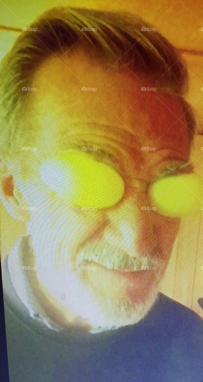 Man with yellow plastic eggs over his eyes being goofy.