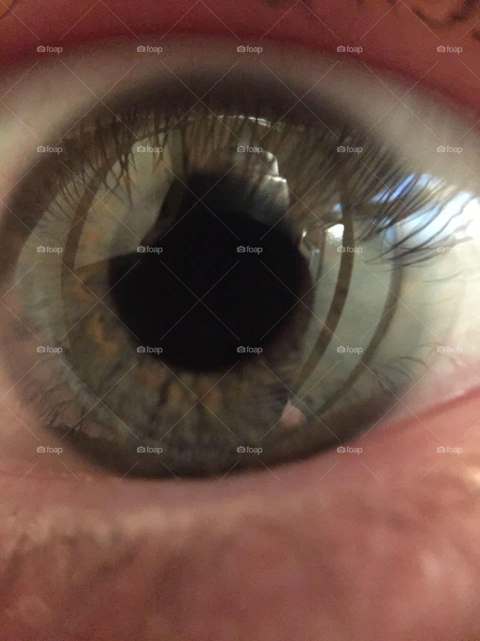 The window to the soul