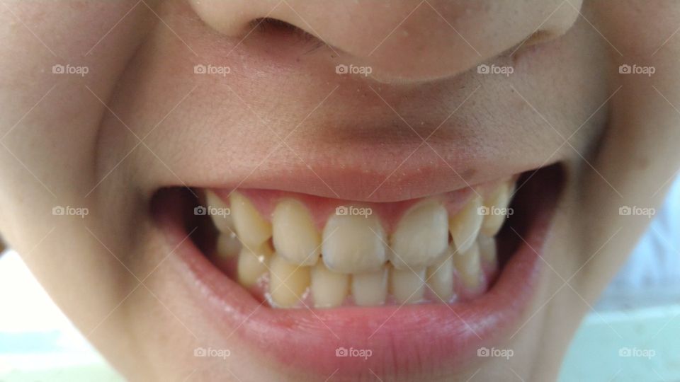 Teeth, Mouth, Dentistry, Tooth, Lips