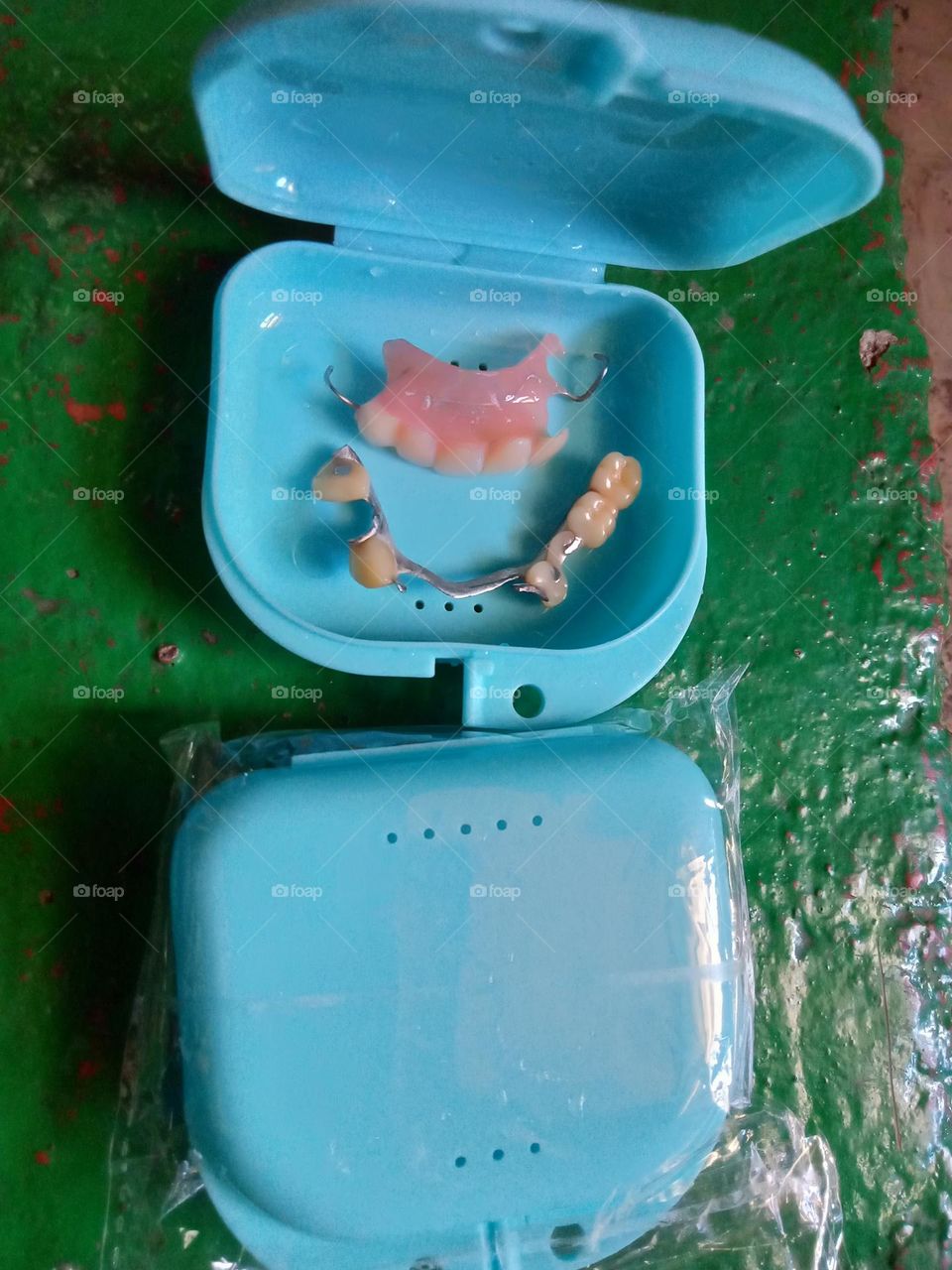 A SET OF TOOTH DENTURE WITH A BLUE DENTURE CASE,,