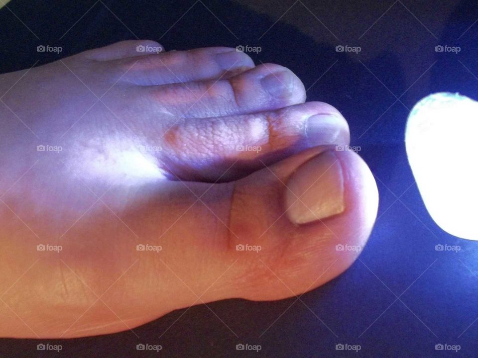 light on toes