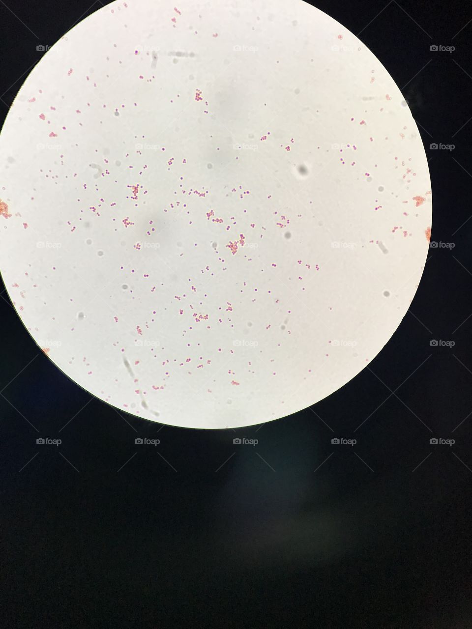 Compact microscope image of organism contaminating water bath; this is perfect to test students in lab courses in college on their knowledge of gram negative vs gram positive- this image is gram negative 