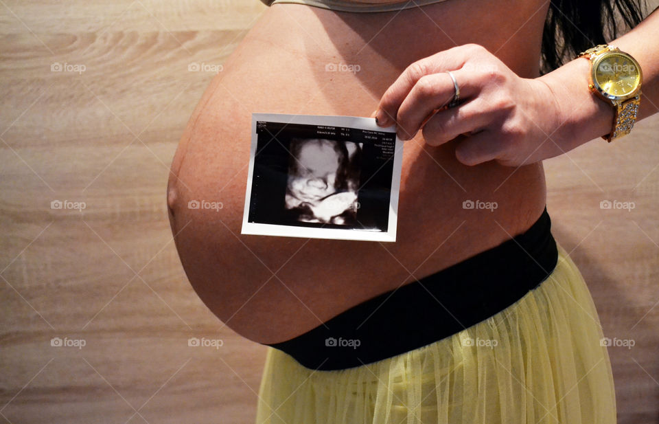 Pregnant photoshoot part 3