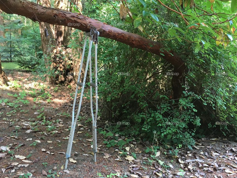 Tree limb supported by crutches