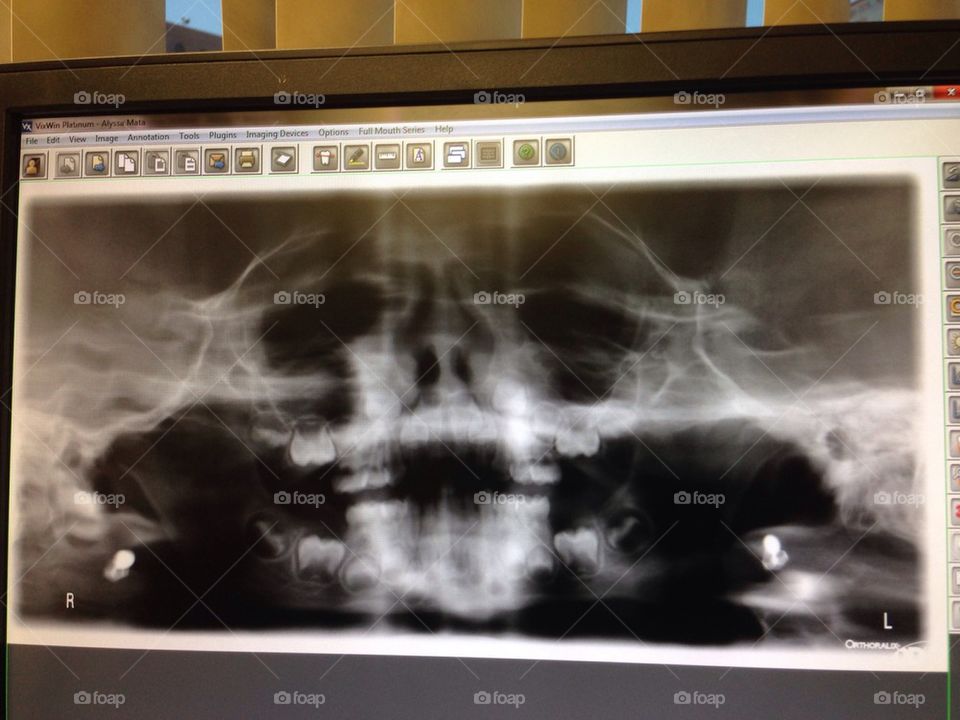 1st Dental x-Ray 