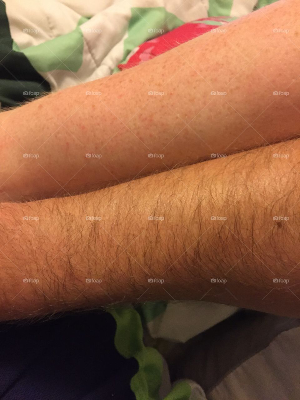 Two different skin colors