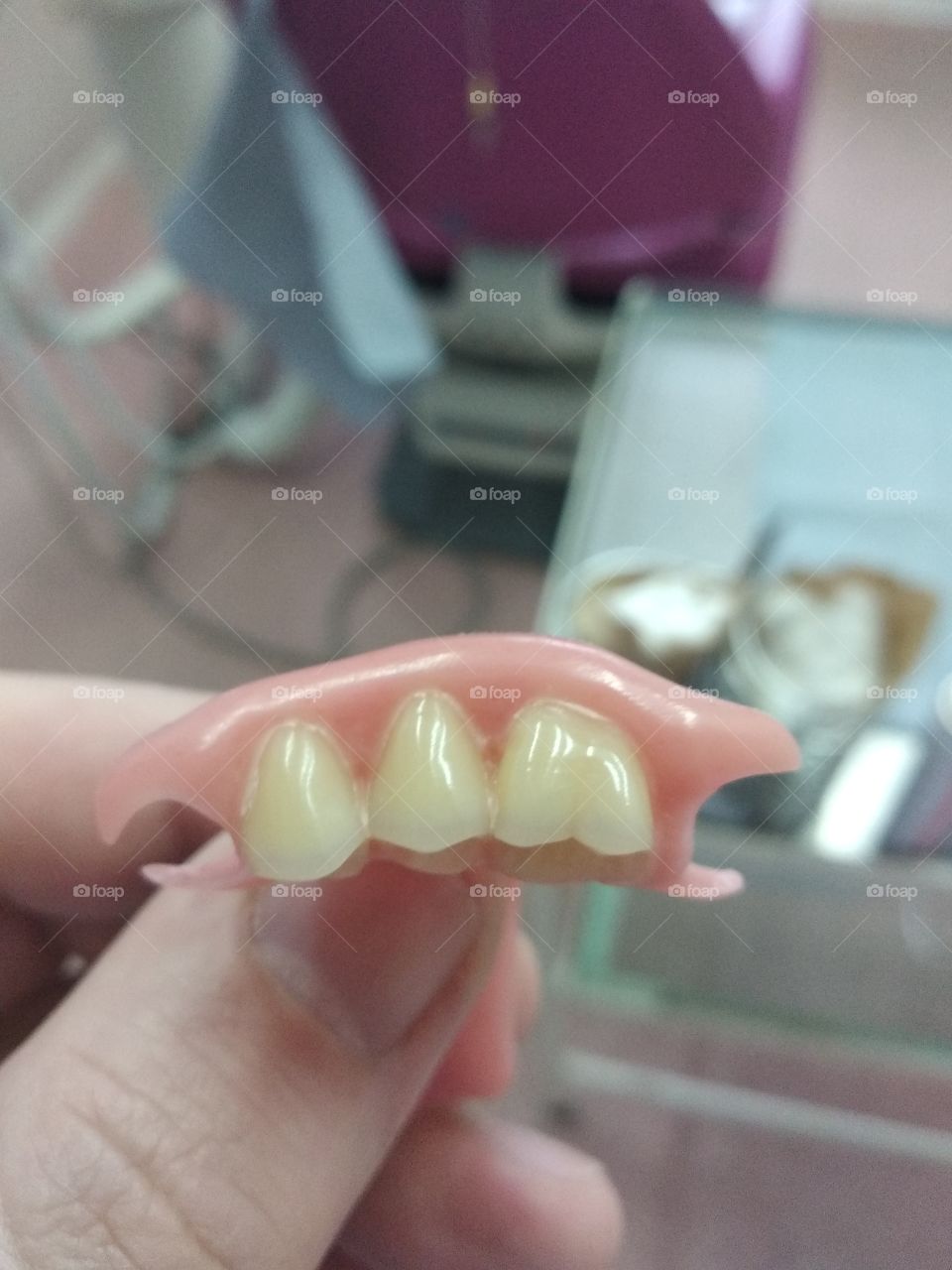 Modern nylon denture
