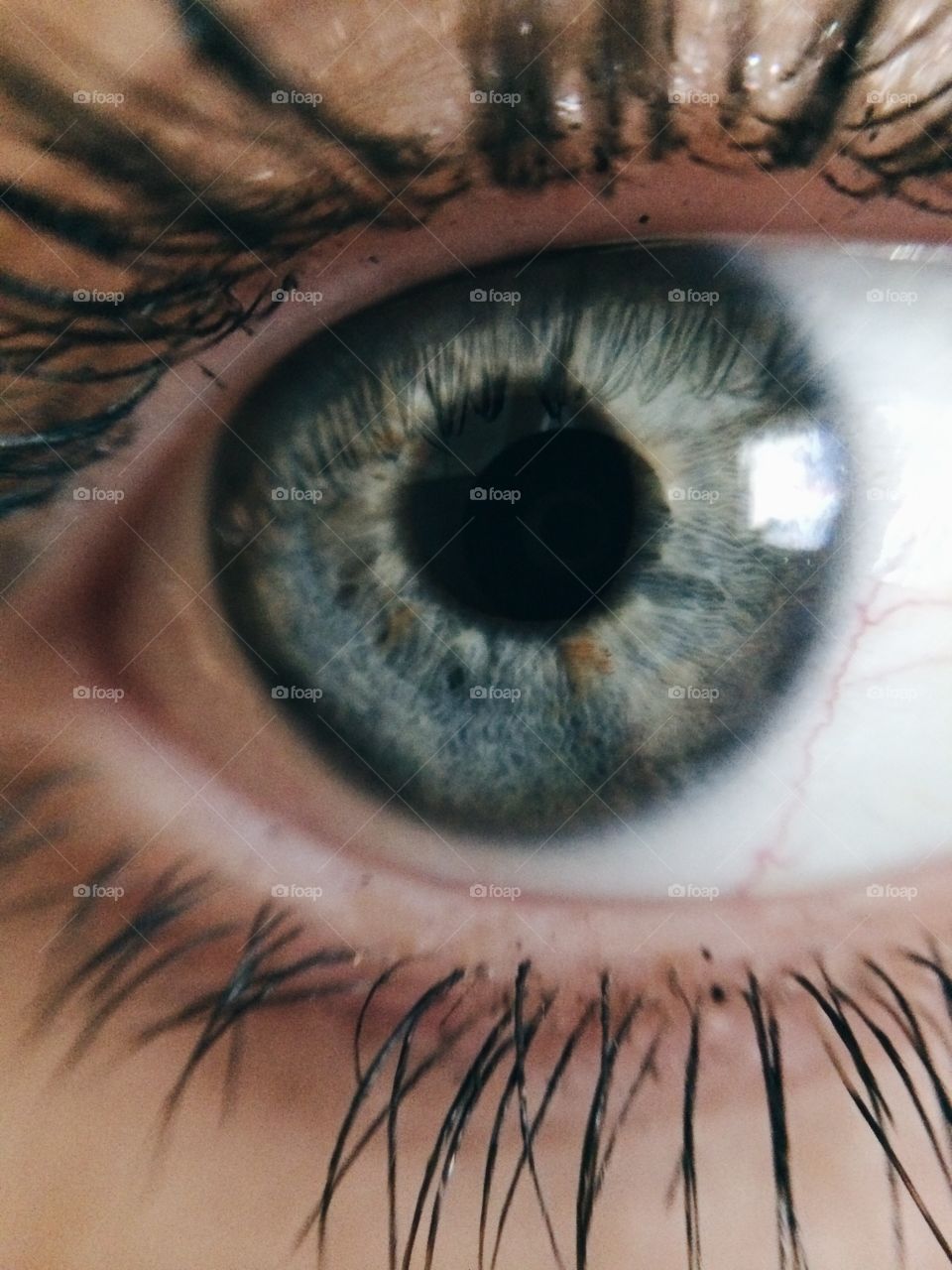 Eye