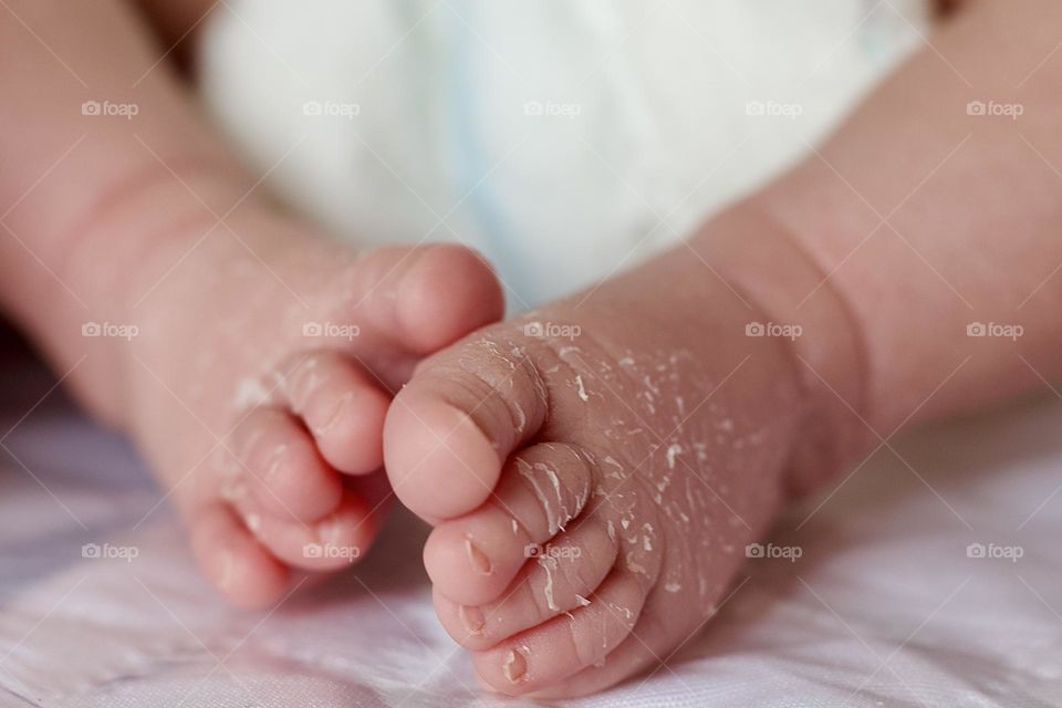 close-up of newborn's skin