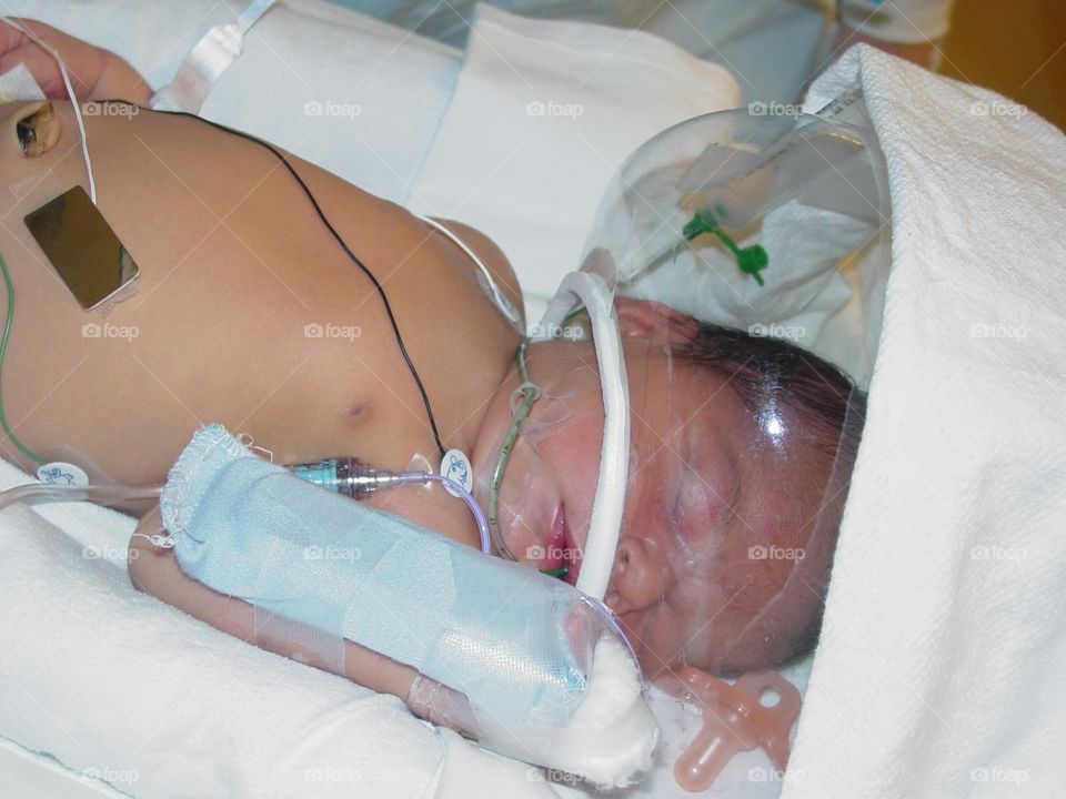 Intensive care unit neonatal
