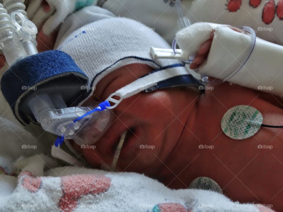 Newborn Infant In Intensive Care

