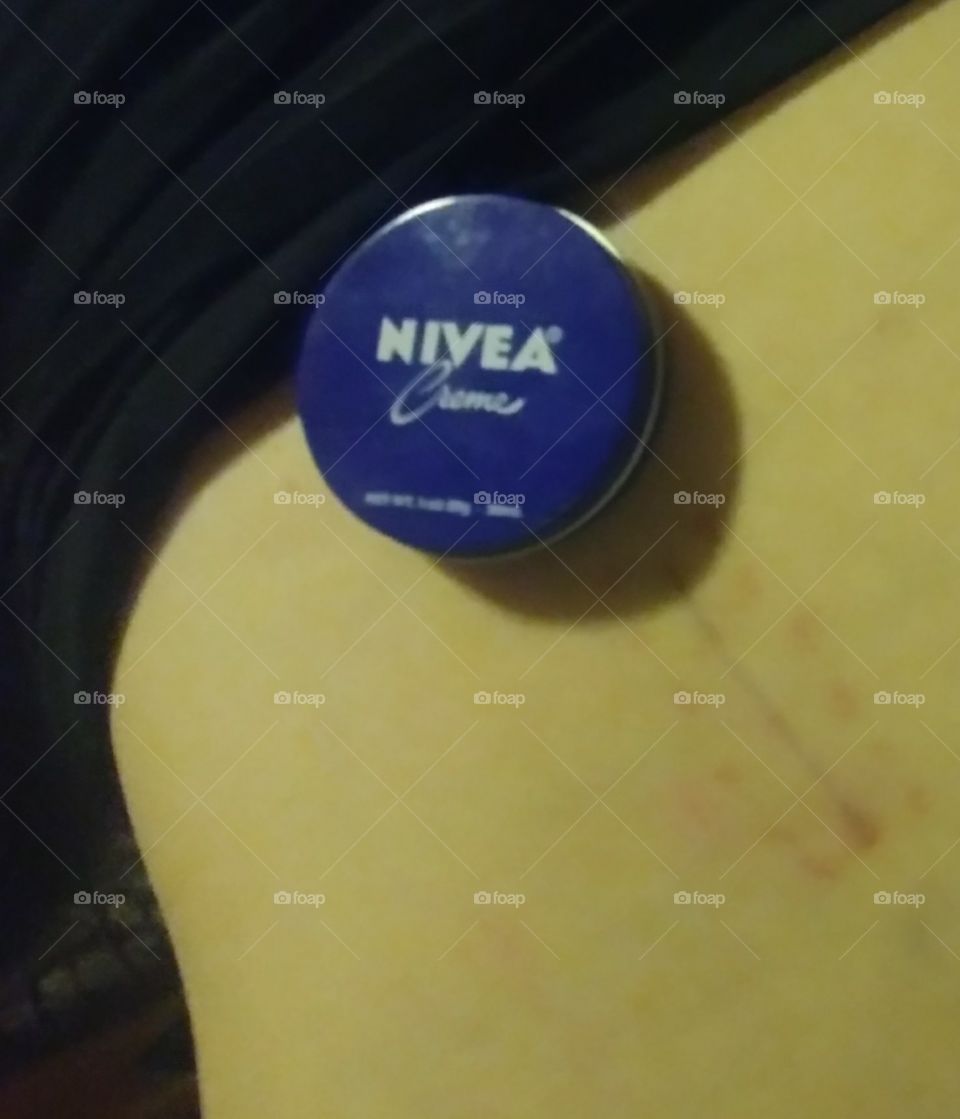 Post surgery and Nivea Cream has been a blessing for me