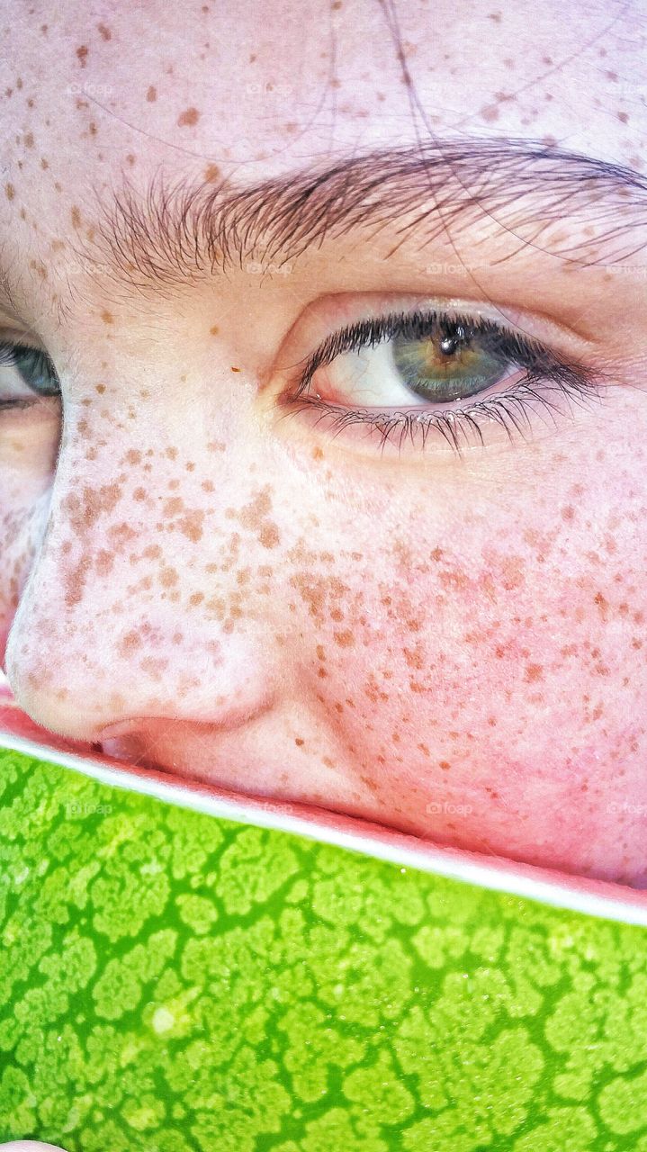 girl with freckles eating watermelon outdoors