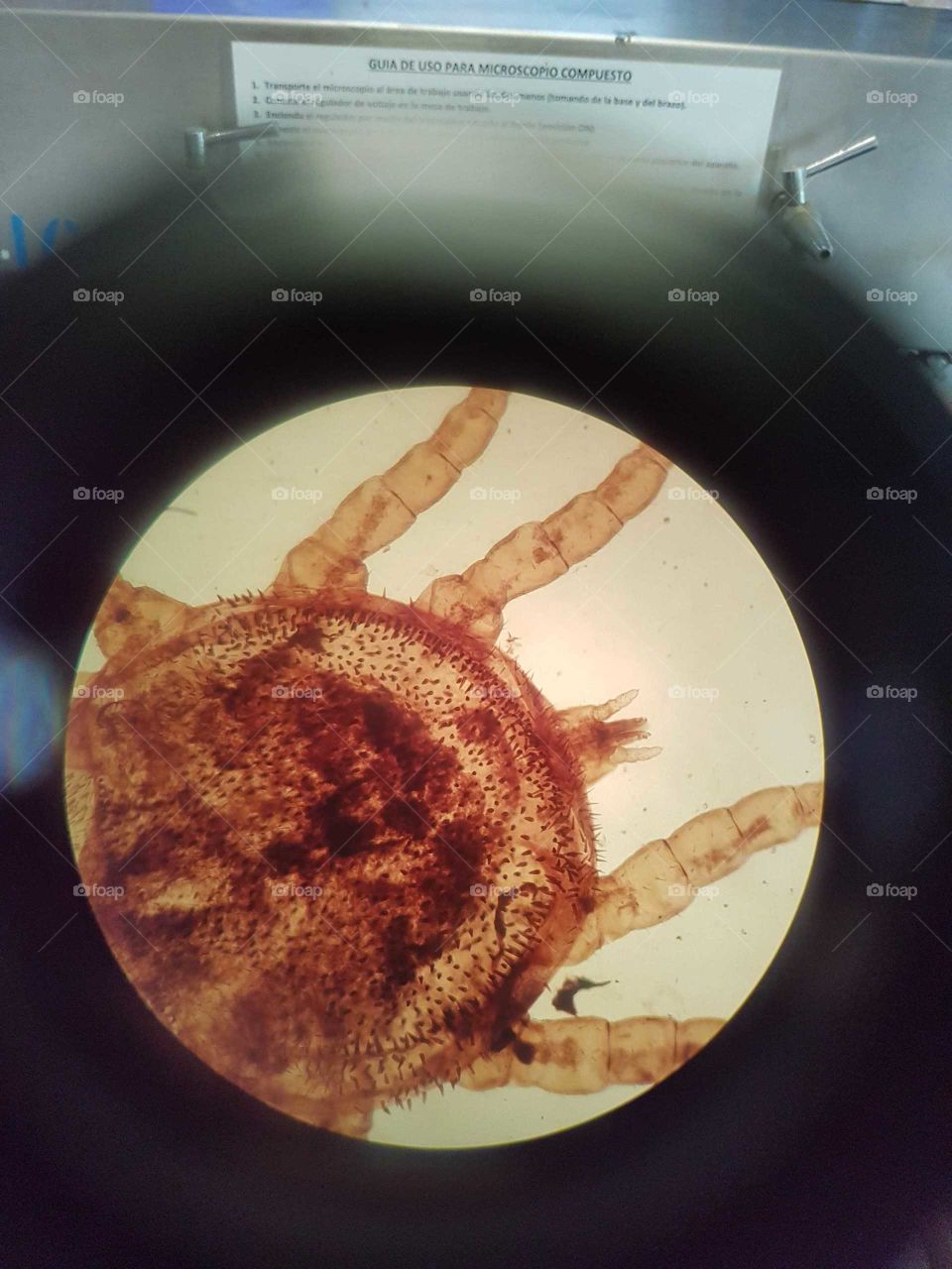 Psoroptes cuniculi, mite. Microscopic picture.