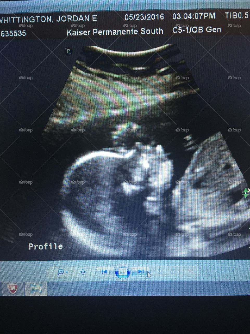 My baby's ultrasound 