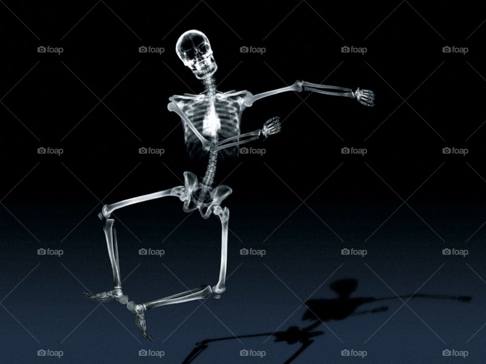 X-ray skeleton