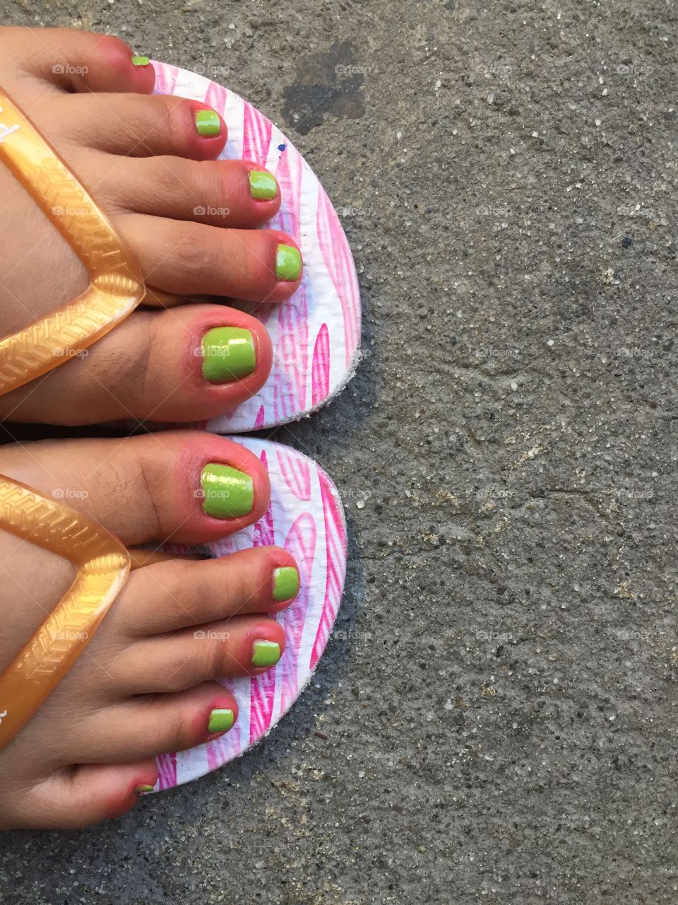 Green toe nails