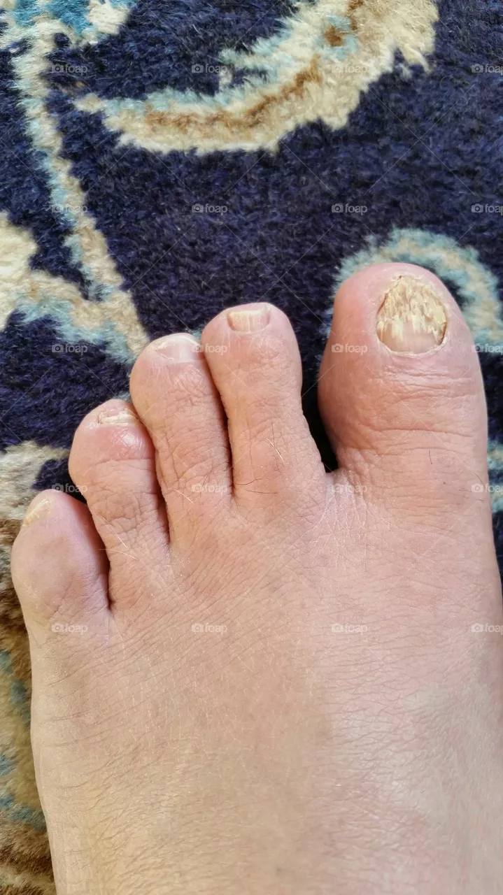 Hand, People, Foot, Man, Skin
