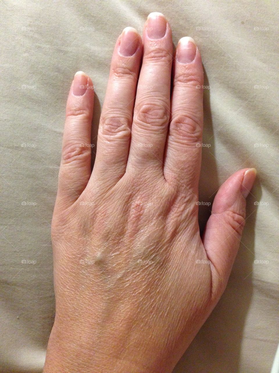 The is a female Caucasian age 44 hand.