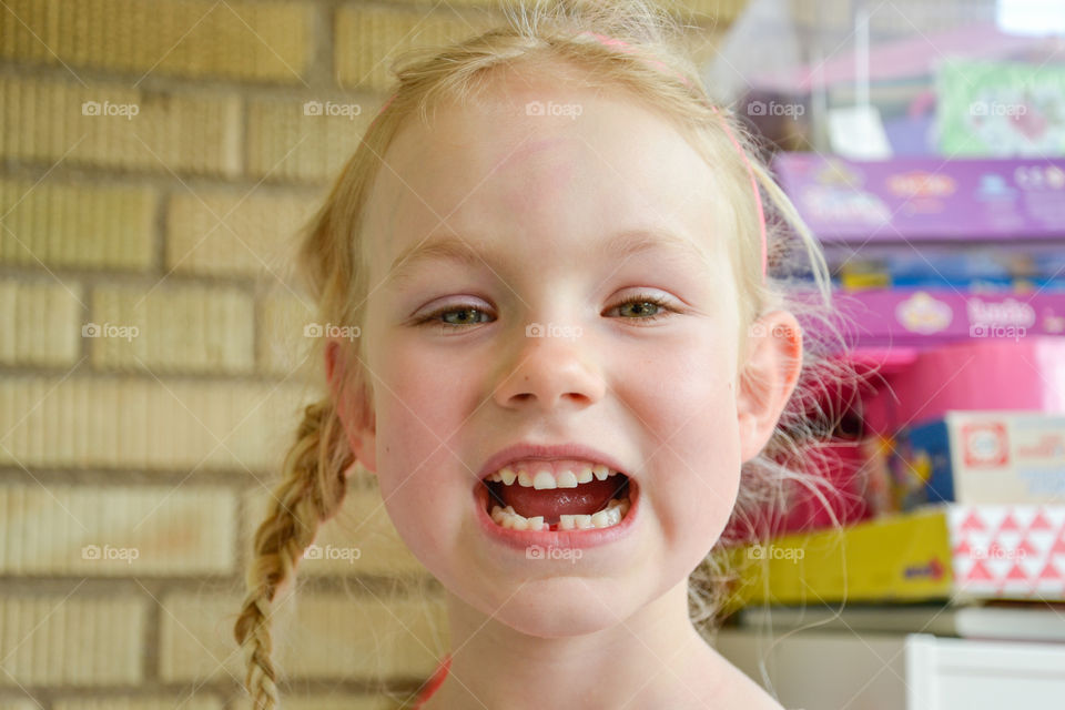 Three year old girl has lost her first tooth.