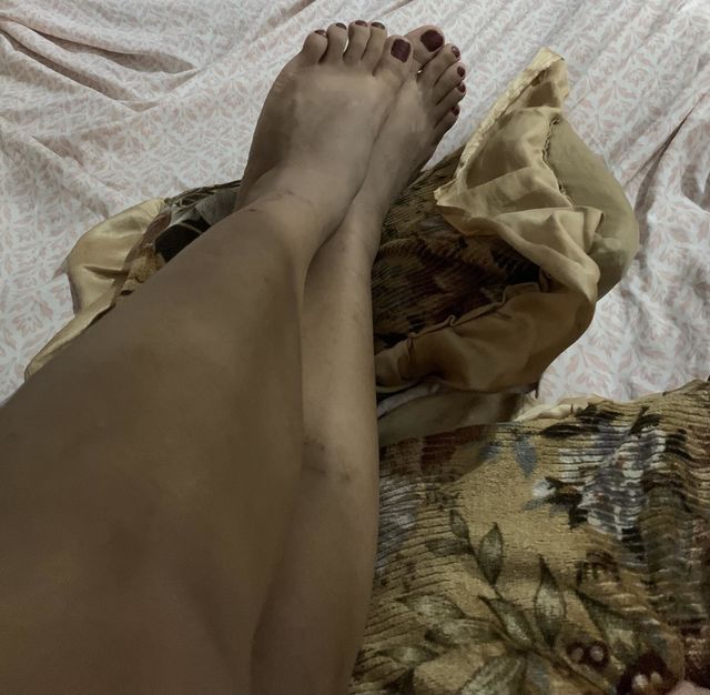 Lindos pies 