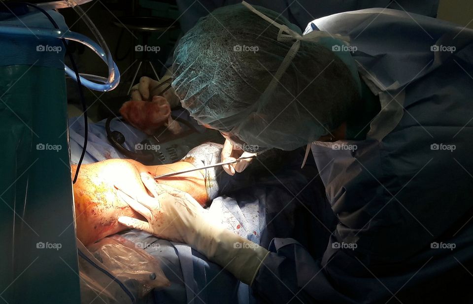 Arthroscopic procedure of the knee(surgery mode on)