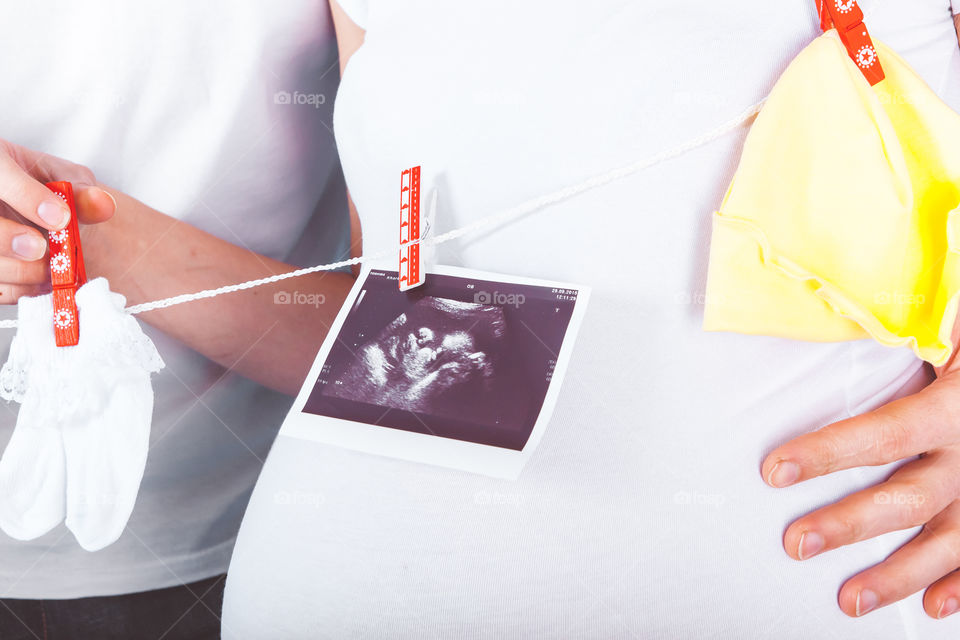 Sonogram picture in front of couple. Ultrasound scan of baby, hat, socks and rattle on clothesline with clothespins in front of expectant parents