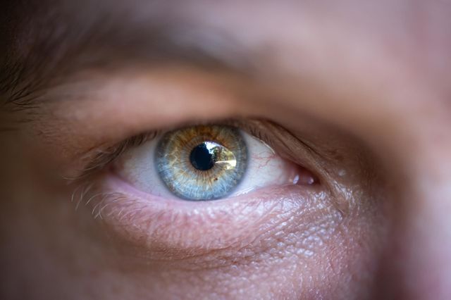 Bright Eye
