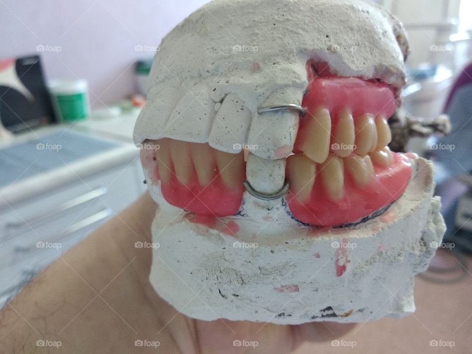 Wax denture