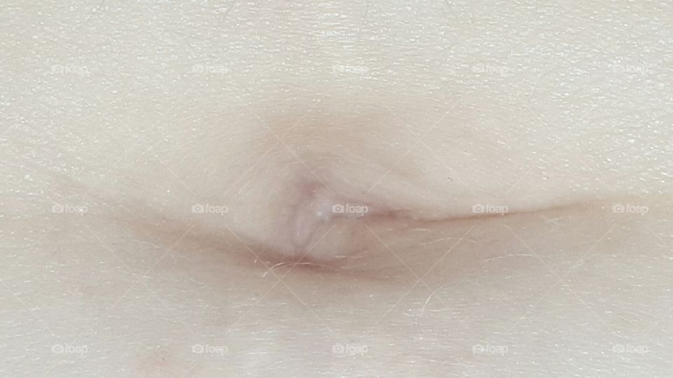 belly button