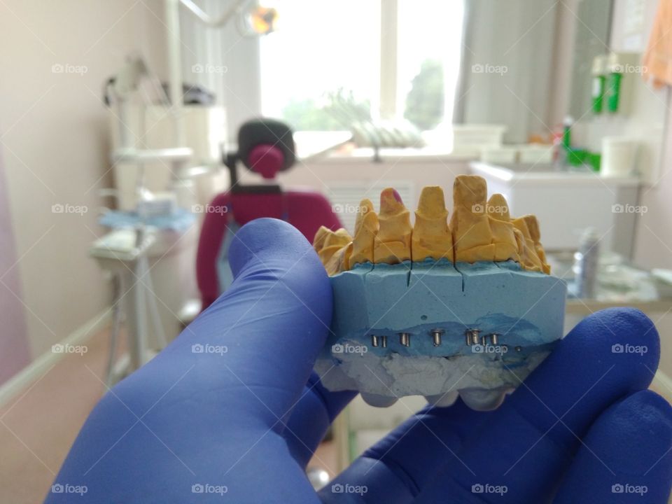Dental model