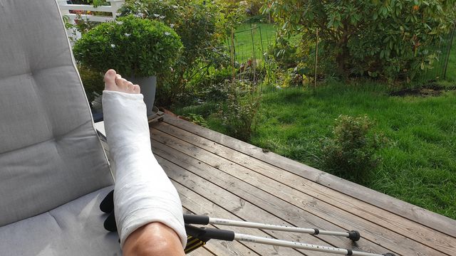 Short leg cast  foot surgery - gips underben fotoperation 
