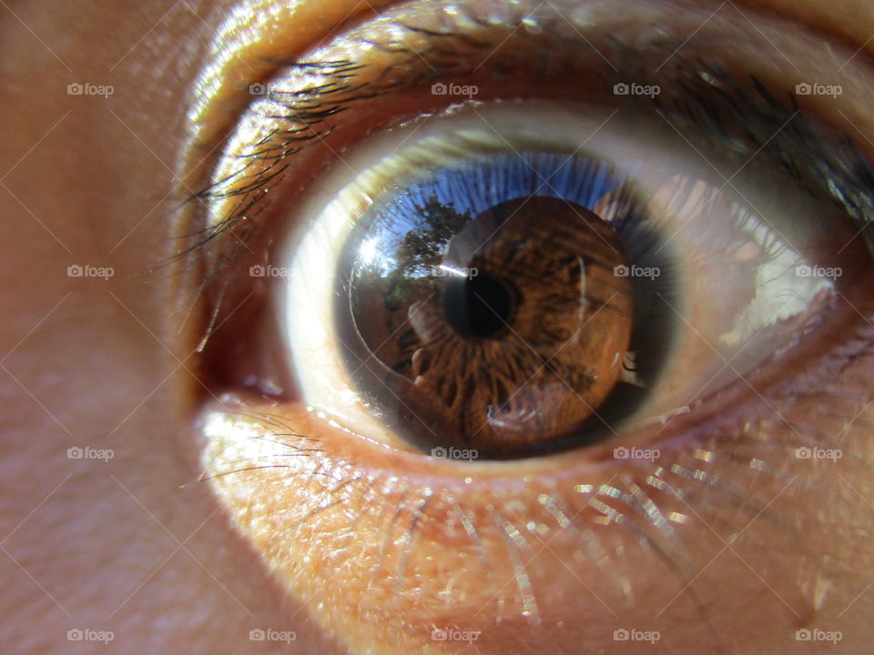 iris eye