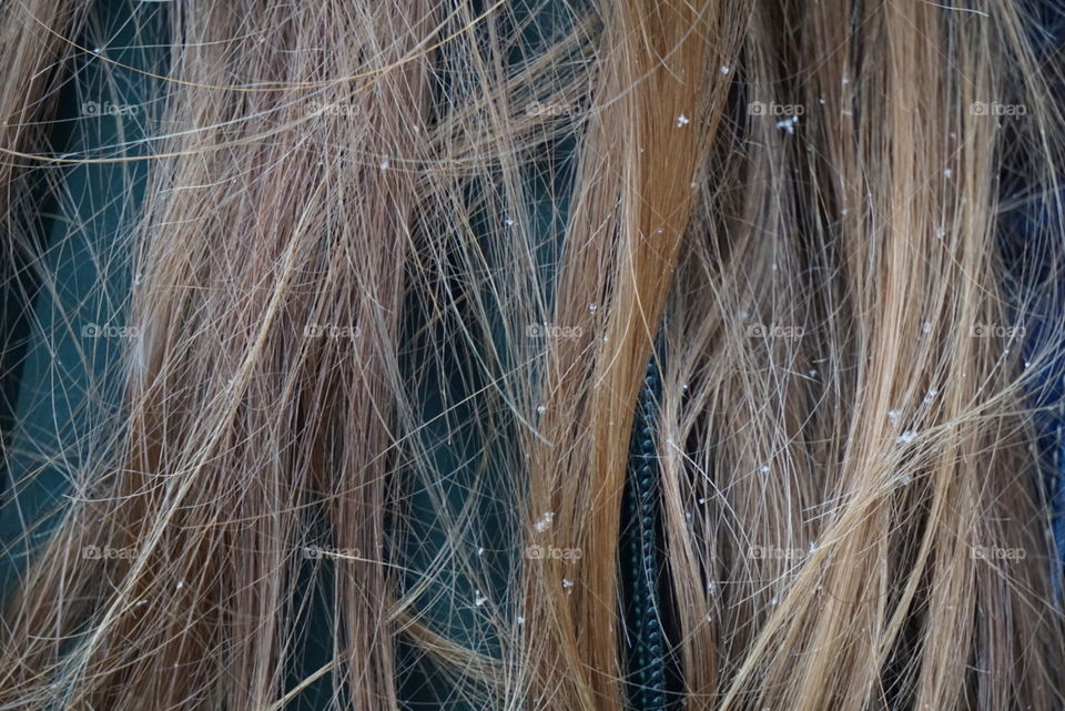 Snowflakes on strands of hair. 