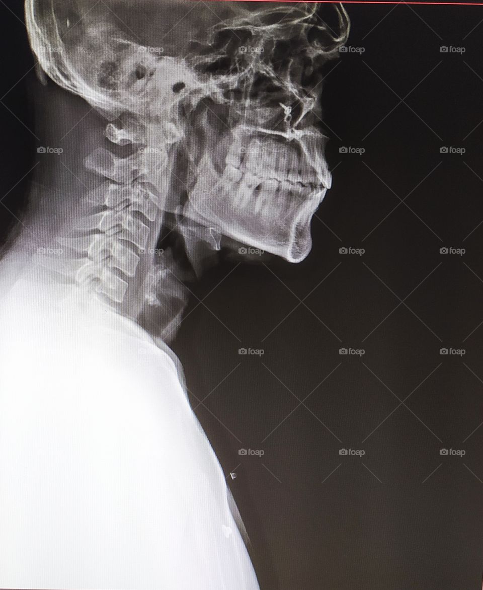 Skull lateral xray view of human body
